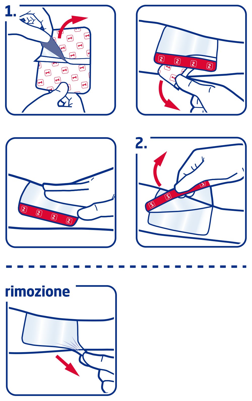 Come utilizzare Leukomed T Come utilizzare Leukomed T